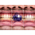 SmileKit V34 Корректор цвета зубов, 30 мл, изображение 9