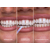 SmileKit Glostik Блеск для зубов, 4 мл, изображение 5